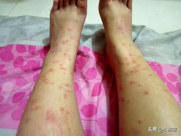 房间怎么彻底除虫（房间怎么彻底除虫咬人）