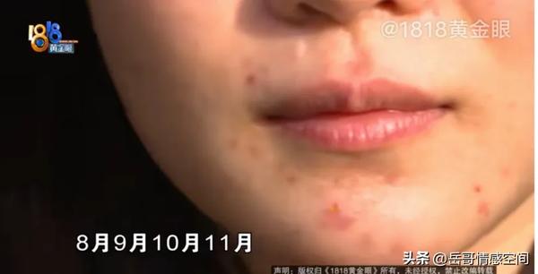 疙瘩长什么样图片(蔬菜疙瘩长什么样图片)