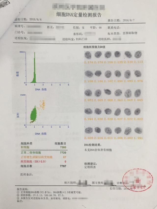 宫颈DNA定量细胞学检查是干什么用的？