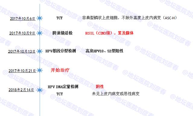 病例分享——25岁的宫颈高度病变患者