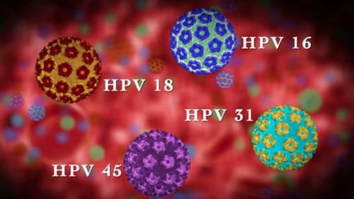 低危型HPV病毒会上升为高危型吗？