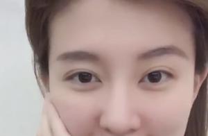 Qiao Xin unplugs strut of the cheek after wisdom t