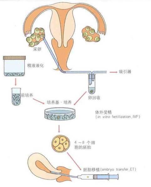试管婴儿过程费用(一个试管婴儿全部费用)