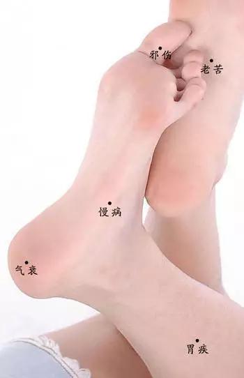 偏僻疾痣是什么意思男人偏僻疾是什么意思