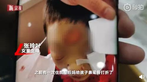 将4岁女童打到多器官衰竭，这样的继母也配当人？