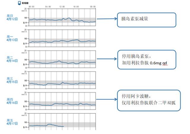 借力动态血糖图谱分析，优化患者血糖管理