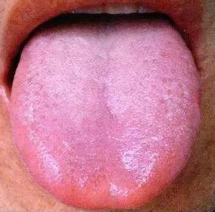 身体好坏写在舌头上，五脏六腑哪里不好，伸伸舌头就知道