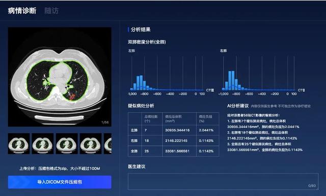 百度战“疫”，AI总动员-锋巢网