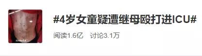 将4岁女童打到多器官衰竭，这样的继母也配当人？